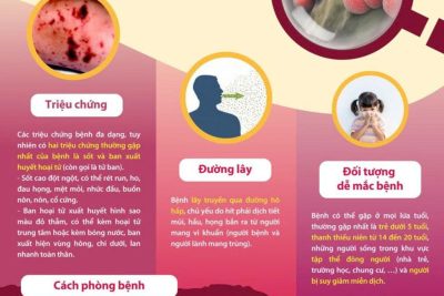 BỆNH NÃO MÔ CẦU TRONG TRƯỜNG HỌC